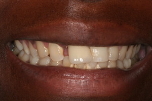 Paciente de caso Dentista Low Cost