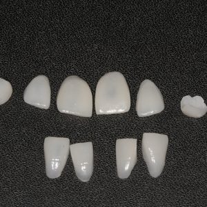Facetas Dentárias de Cerâmica ou Porcelana