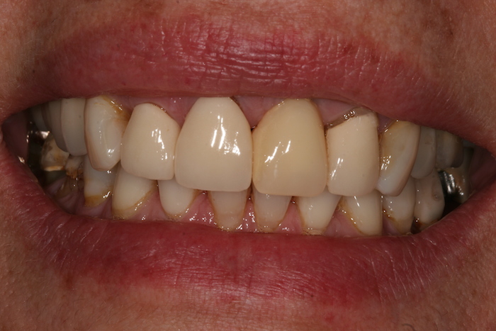 reabilitacao-oral:antes