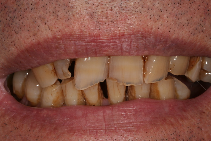 dentes-estetica|implantes|reabilitacao-oral:antes
