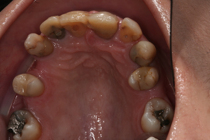 dentes-estetica|reabilitacao-oral:antes
