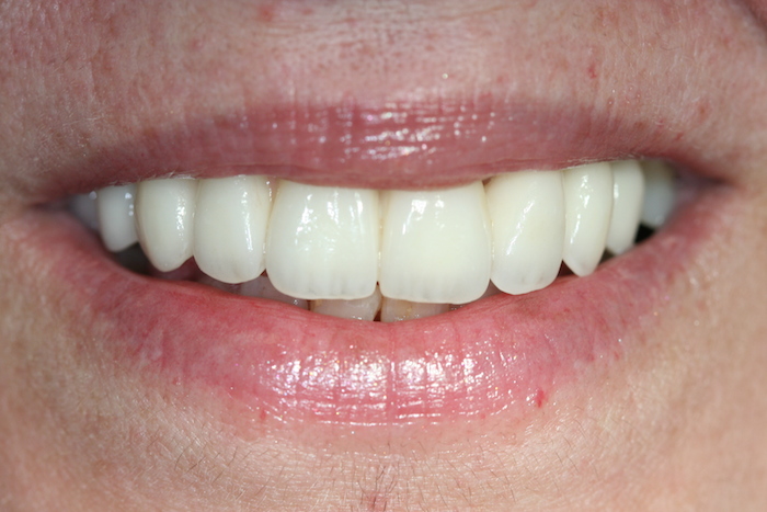 dentes-estetica|reabilitacao-oral