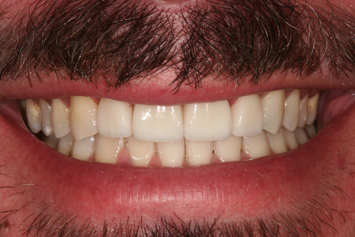 branqueamento-dentario|dentes-estetica|ortodontia