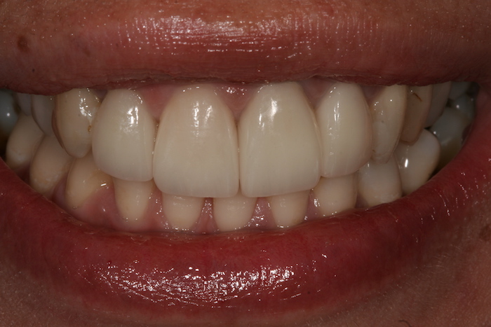 dentes-estetica