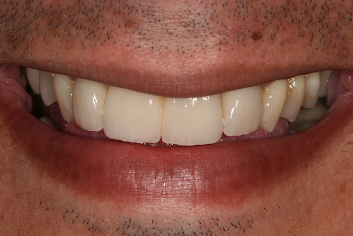 dentes-estetica|reabilitacao-oral